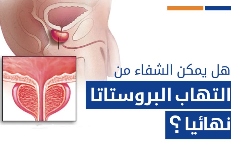 هل يمكن الشفاء من تضخم البروستاتا و ما هي طرق العلاج؟